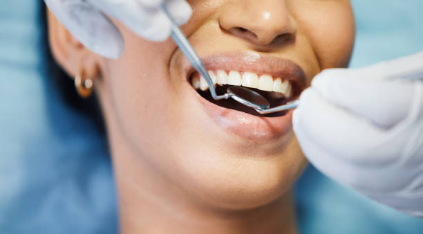 Best Walk-In Emergency Dental Services in Ingleside, TX